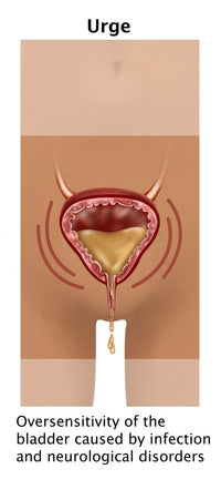 Urge Incontinence Poster Print by Gwen Shockey - Educational Art