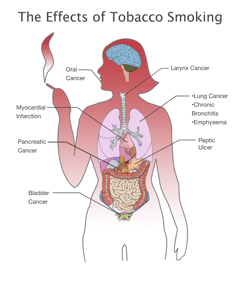 Effects of Tobacco Smoking Educational Poster Print by Spencer Sutton