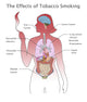 Effects of Tobacco Smoking Educational Poster Print by Spencer Sutton