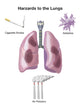 Hazards to the Lungs Poster Print showcasing lung health awareness.