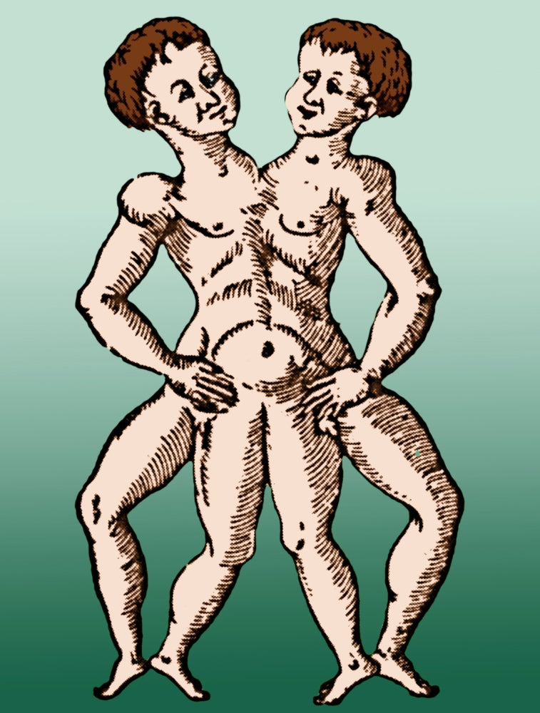 Conjoined Twins 16th Century Poster Print showcasing historical artwork.