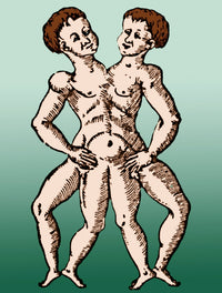 Conjoined Twins 16th Century Poster Print showcasing historical artwork.