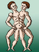 Conjoined Twins 16th Century Poster Print showcasing historical artwork.