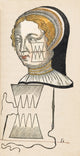 Pare Suture 1500s Poster Print showcasing historical medical techniques.