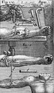 Techniques of Blood Transfusion, 1667 Poster Print showcasing historical medical advancements.