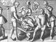 Trepanning Being Performed, 1594 Poster Print showcasing an ancient medical practice.