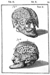 Brain Exposed 17th Century Illustration Poster Print