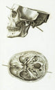 Skull with Head Wound 1829 illustration poster print.