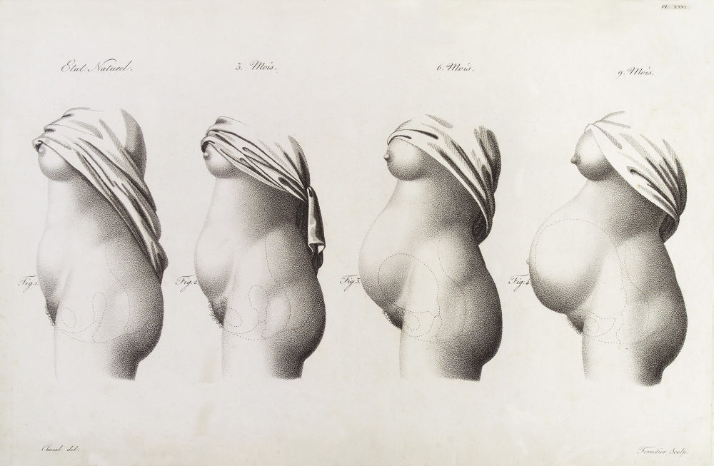 Pregnancy Trimesters Illustration Poster Print depicting the changes during pregnancy.