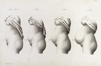 Pregnancy Trimesters Illustration Poster Print depicting the changes during pregnancy.