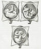 Historical illustration of pregnancy complications from 1668, available as a poster print.
