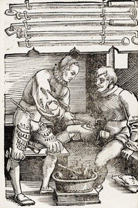 Thigh Cauterization 16th Century Medicine Poster Print