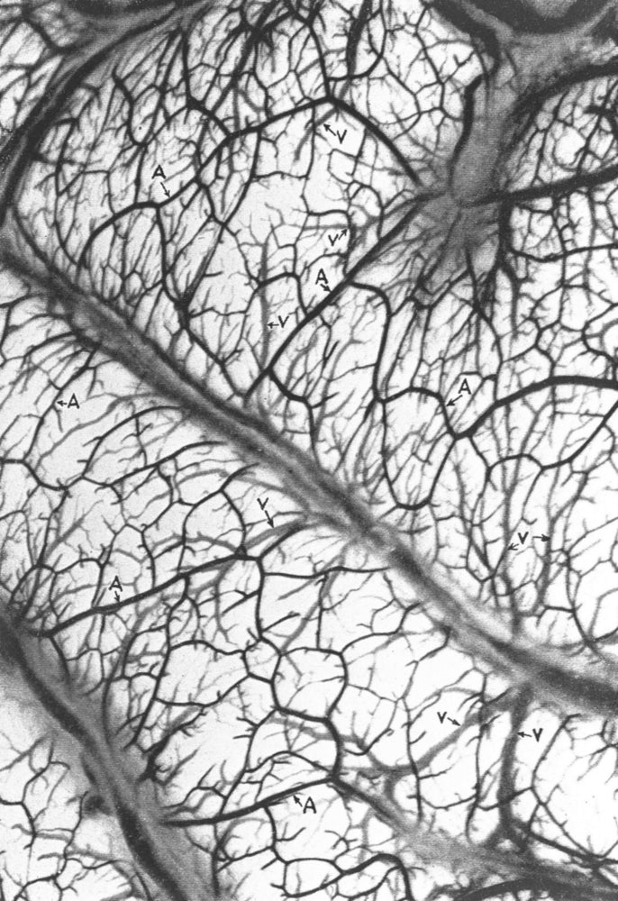 Brain Arteries and Veins Poster Print showcasing detailed anatomical illustrations.