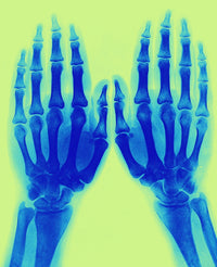 X-Ray of Two Normal Hands, 1896 Poster Print