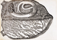Heart with Parasite poster print showcasing a detailed scientific illustration.