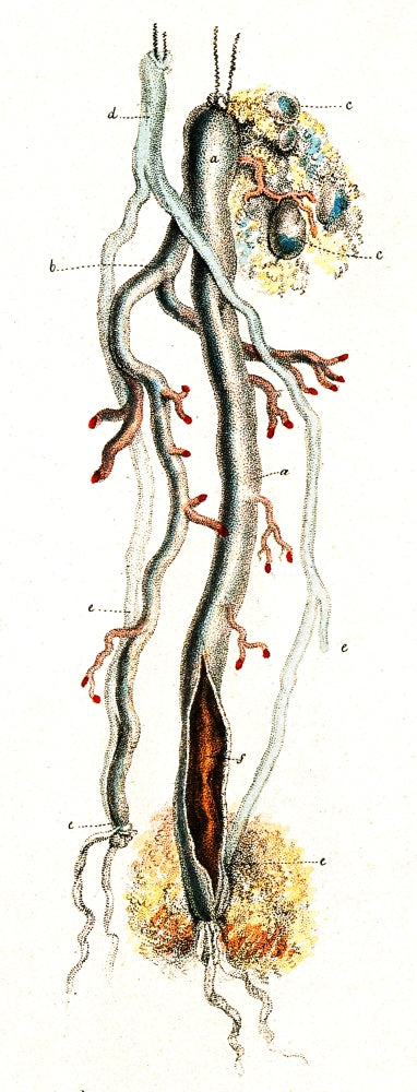 Amputated Nerve and Artery illustration poster print on premium paper.