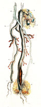 Amputated Nerve and Artery illustration poster print on premium paper.