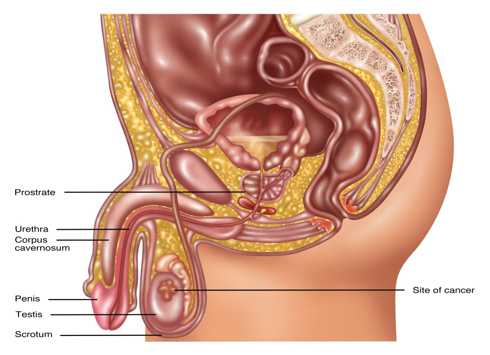 Testicular Cancer Educational Illustration Poster Print by Gwen Shockey