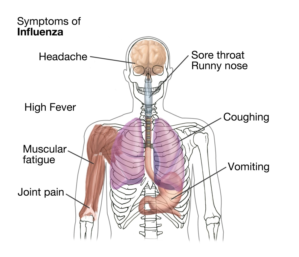 Symptoms of Influenza Educational Poster Print by Science Source