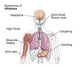 Symptoms of Influenza Educational Poster Print by Science Source