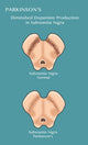 Substantia Nigra & Parkinson's Disease Poster Print showcasing detailed neuroscience illustration