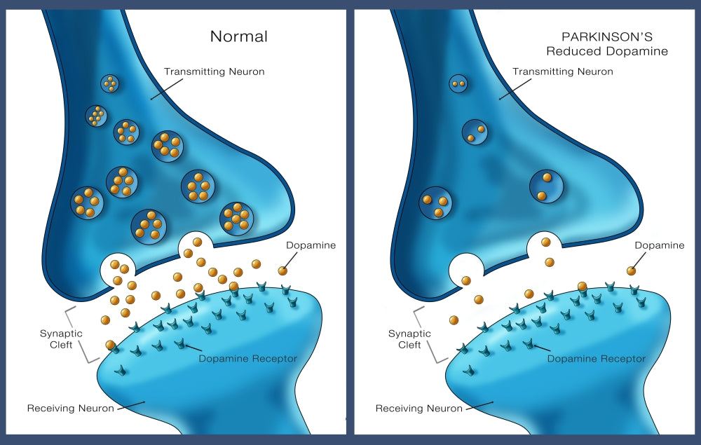 Parkinson's & Dopamine Poster Print by Monica Schroeder, educational art for neuroscience.