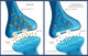Parkinson's & Dopamine Poster Print by Monica Schroeder, educational art for neuroscience.