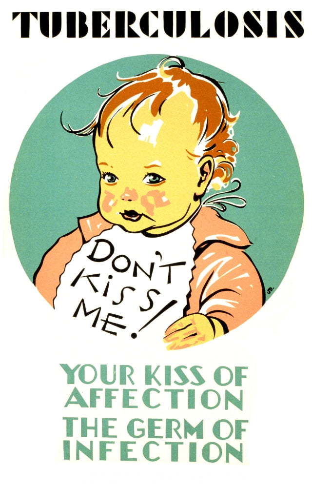 Tuberculosis FAP Poster Print from 1941 showcasing vintage health awareness design.