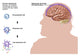 Chronic Senescence and Brain Shrinkage Poster Print showcasing brain health concepts.