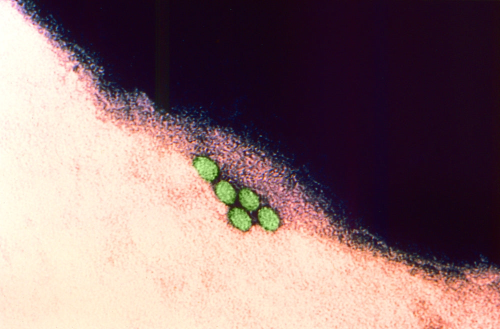 Enterovirus TEM Poster Print showcasing detailed virus structure.