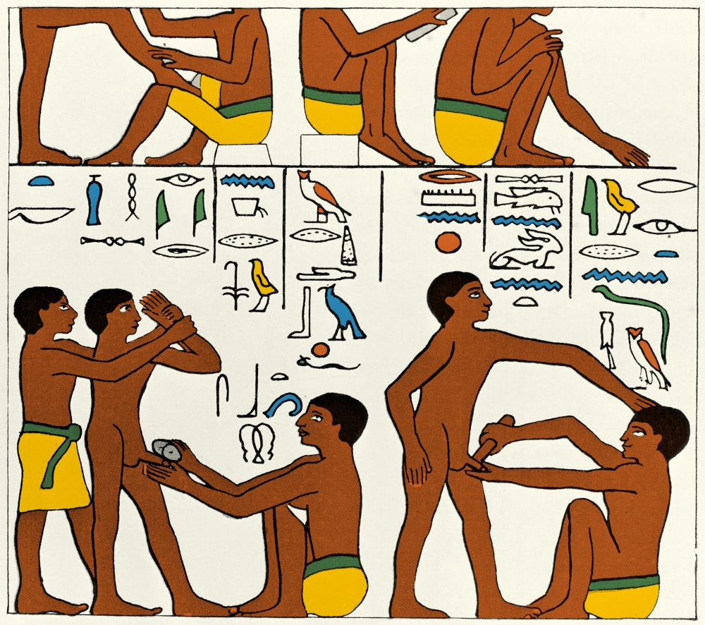 Circumcision in Ancient Egypt poster print depicting 2600 BC ritual