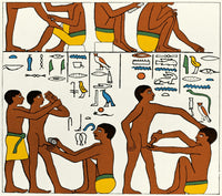 Circumcision in Ancient Egypt poster print depicting 2600 BC ritual