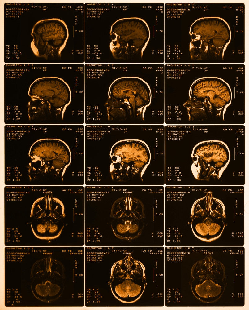 MRI of Normal Brain Fine Art Print by Science Source
