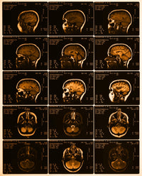MRI of Normal Brain Fine Art Print by Science Source