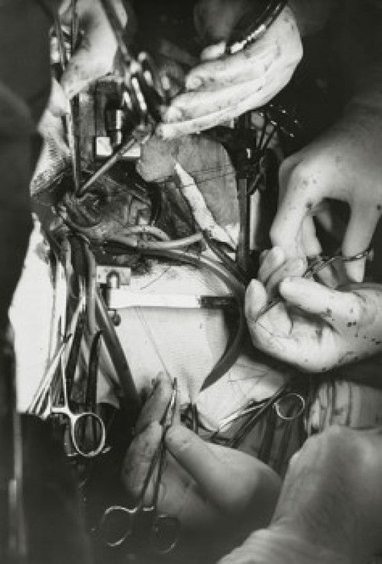 Close-up of Surgeon’s Hands Performing Open-Heart Surgery Poster Print
