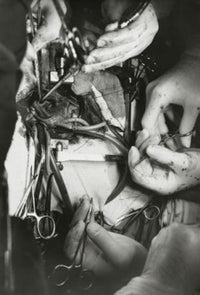 Close-up of Surgeon’s Hands Performing Open-Heart Surgery Poster Print