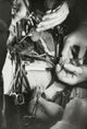 Close-up of Surgeon’s Hands Performing Open-Heart Surgery Poster Print