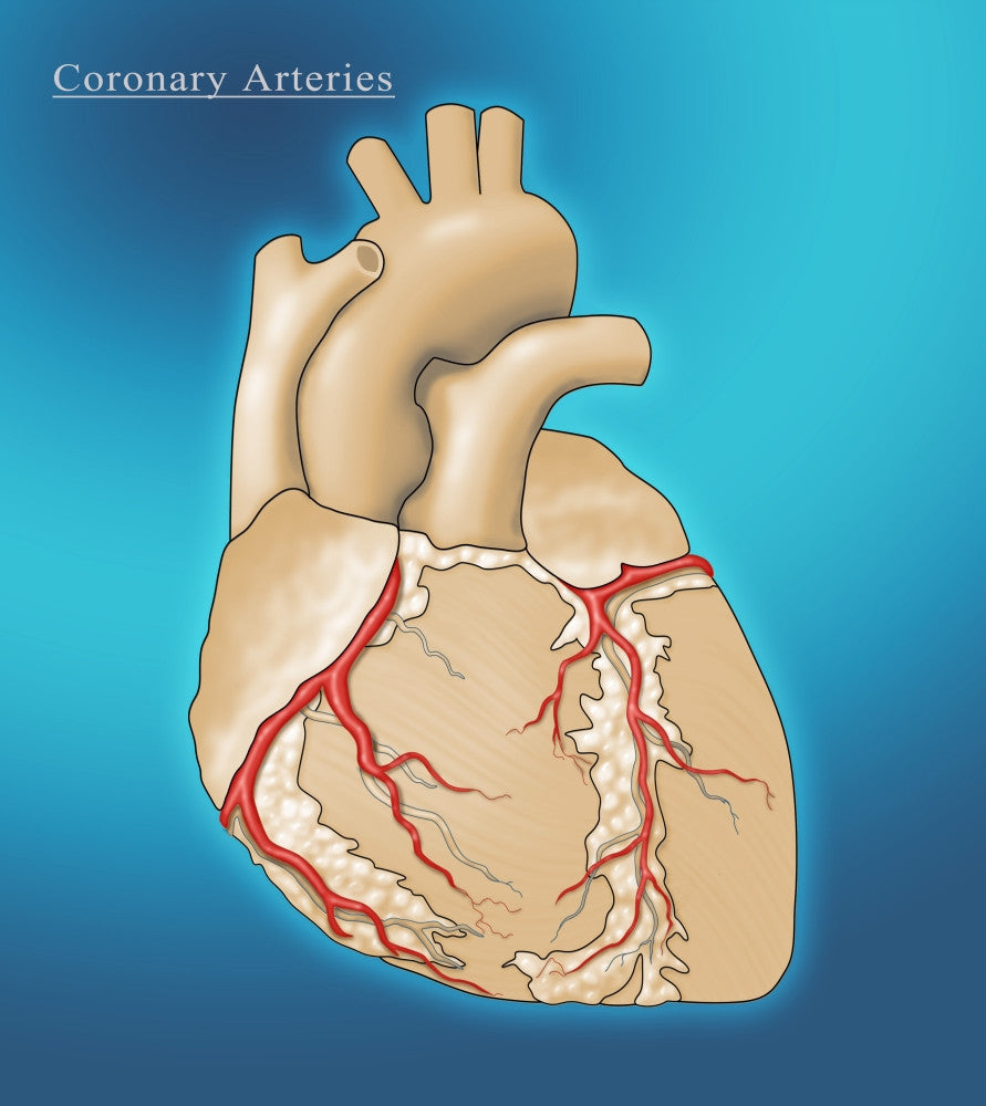 Coronary Arteries Fine Art Print by Monica Schroeder | Science Source