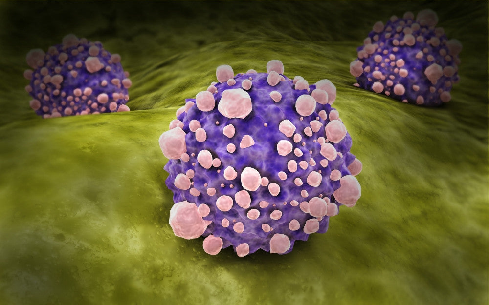 Microscopic View of Pancreatic Cancer Cells Fine Art Print