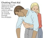 Heimlich Maneuver Fine Art Print by Gwen Shockey | Science Source