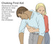 Heimlich Maneuver Fine Art Print by Gwen Shockey | Science Source