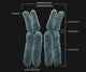 Homologous Chromosomes with Annotations Fine Art Print by Photon Illustration