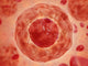 Cell Nucleus with Chromosome Fine Art Print - StockTrek Images