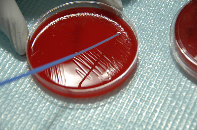 Staphylococcus Bacteria Fine Art Print from Human Skin by NIH/Stocktrek Images