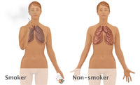 Lungs of Smoker vs. Non-Smoker Fine Art Print by Gwen Shockey