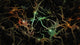 Brain Neurons Vivid Art Print by Bruce Rolff | Stocktrek Images