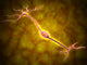 Microscopic View of a Bipolar Neuron Fine Art Print