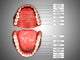 Human Teeth Structure with Labels Fine Art Print