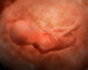 Fetus Development Medical Illustration Poster Print (24 Weeks)