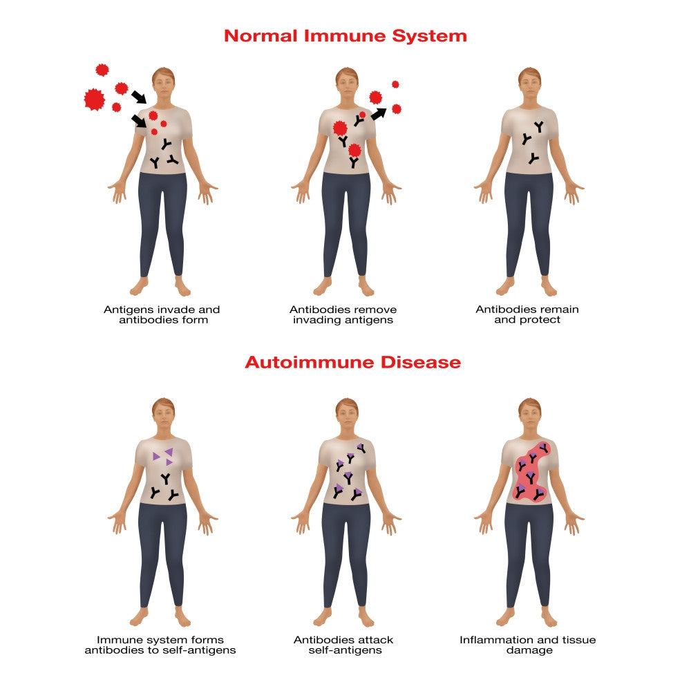Normal Immune System & Autoimmune Disease Fine Art Print by Gwen Shockey